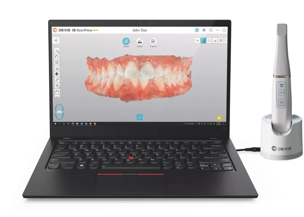 Dexis Intraoral Scanner